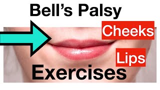 BELL'S PALSY: 4 EXERCISES for lips + cheeks + STRETCHING, Facial Paralysis, Beginner