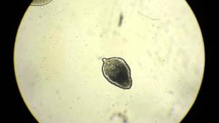 Parasite of Tadpole: Digenea