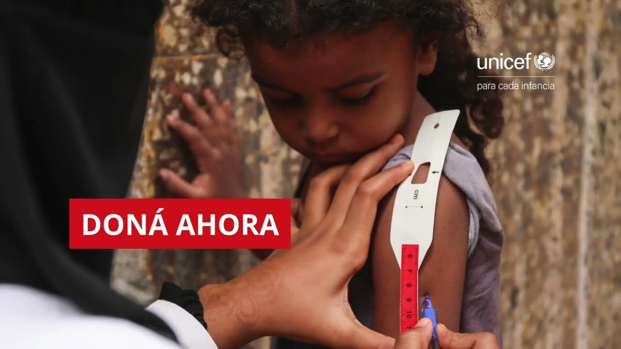 Semáforo de desnutrición aguda 3