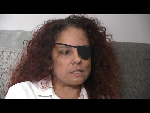 Exclusive: Woman issues warning to travelers after assault in Turks and Caicos