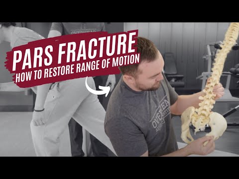 PARS Fracture - How To Restore Range of Motion
