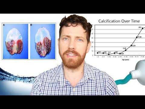 Does Fluoride Really Calcify Your Pineal Gland?