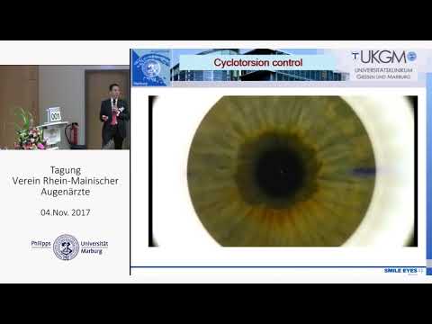 Prof. W. Sekundo: Refraktive Laserchirurgie ... Universitäts-Augenklinik Marburg 11-2017