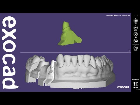 exocad Quick Guide: Extra Jaw Scan