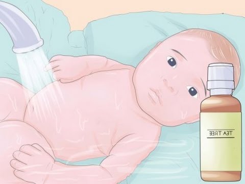 La psoriasis se descama el lunar Las medicinas contra la eccema sobre los codos