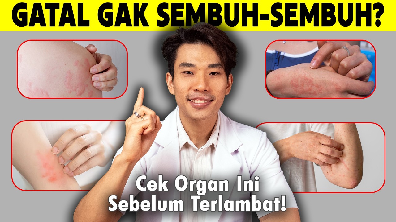 Sering Gatal Tapi Ga Mempan Minum Obat Alergi. Lakukan Ini!