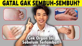 Download lagu Sering Gatal Tapi Ga Mempan Minum Obat Alergi. Lakukan Ini! mp3