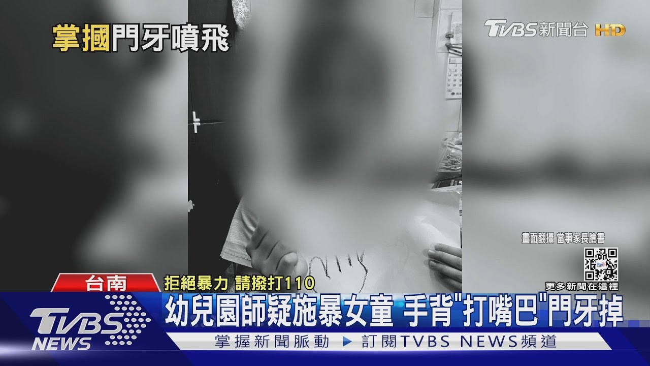 父怒控7歲女遭師拍嘴「門牙噴飛」 園方:吃飯時掉落