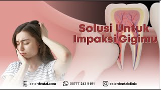 Download lagu Solusi Saat Gigi Geraham Bungsu Tumbuh mp3 Download lagu Solusi Saat Gigi Geraham Bungsu Tumbuh mp3