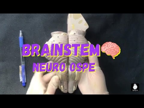 OSPE | BRAINSTEM 🧠 | NEUROANATOMY