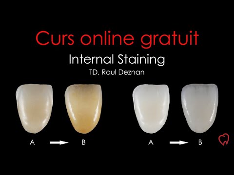 WEBINAR GRATUIT – Internal staining de la A la B