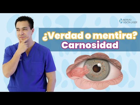 Carnosidad «verdad o mentira»