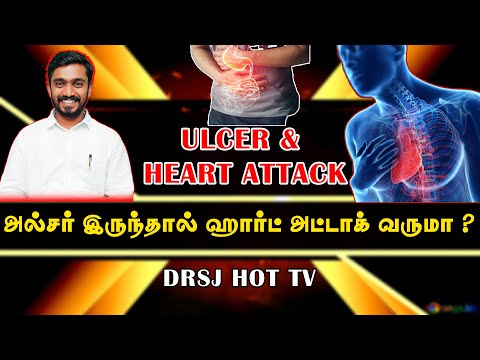 அல்சர் இருந்தால் ஹார்ட் அட்டாக் வருமா? Will Ulcer Acidity cause Heart attackl DrSj in Tamil Video