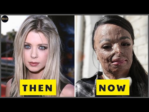 10 Celebs Who Became UNRECOGNIZABLE After Surgery | Then and Now 2026
