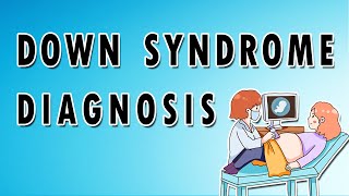 Prenatal Diagnosis of Down Syndrome