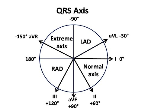 CardioMinds: ECG axis
