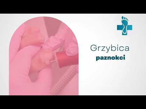 Gabinet podologiczny Zdrowe Stopy Renata Barańczyk - video