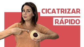 Fissuras mamilares como cicatrizar rápido - ANDRESSA BORTOLASSO