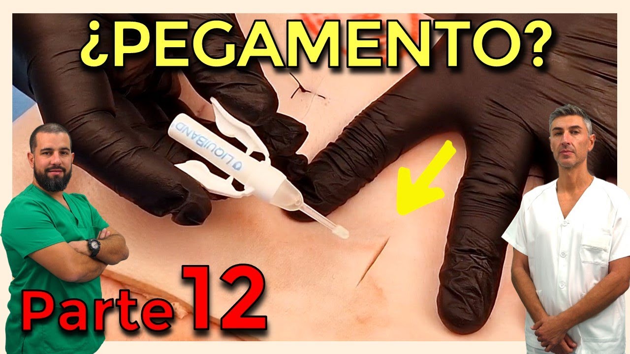 PEGAMENTO BIOLÓGICO – CIRUGÍA MENOR y SUTURAS (Parte 12)