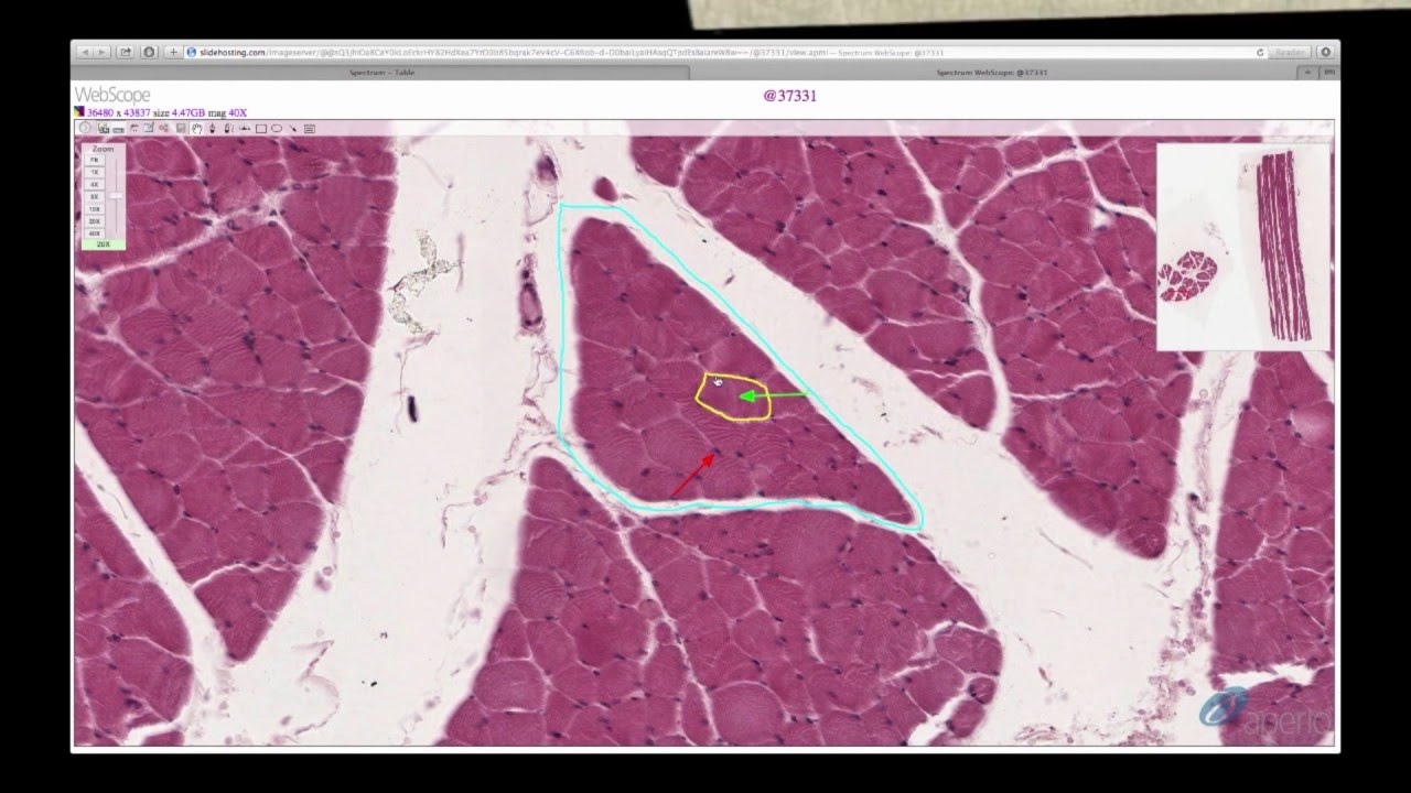 Histology Helper - Muscle Histology