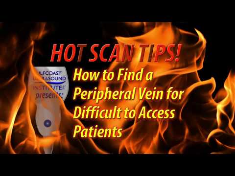 Hot Tip-How to Locate a Peripheral Vein for Difficult to Access Patients