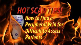 Hot Tip-How to Locate a Peripheral Vein for Difficult to Access Patients