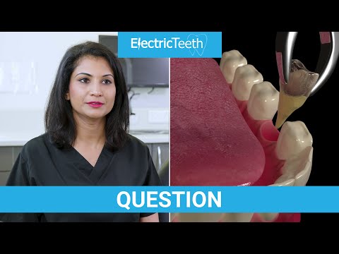 How to heal faster after a tooth extraction