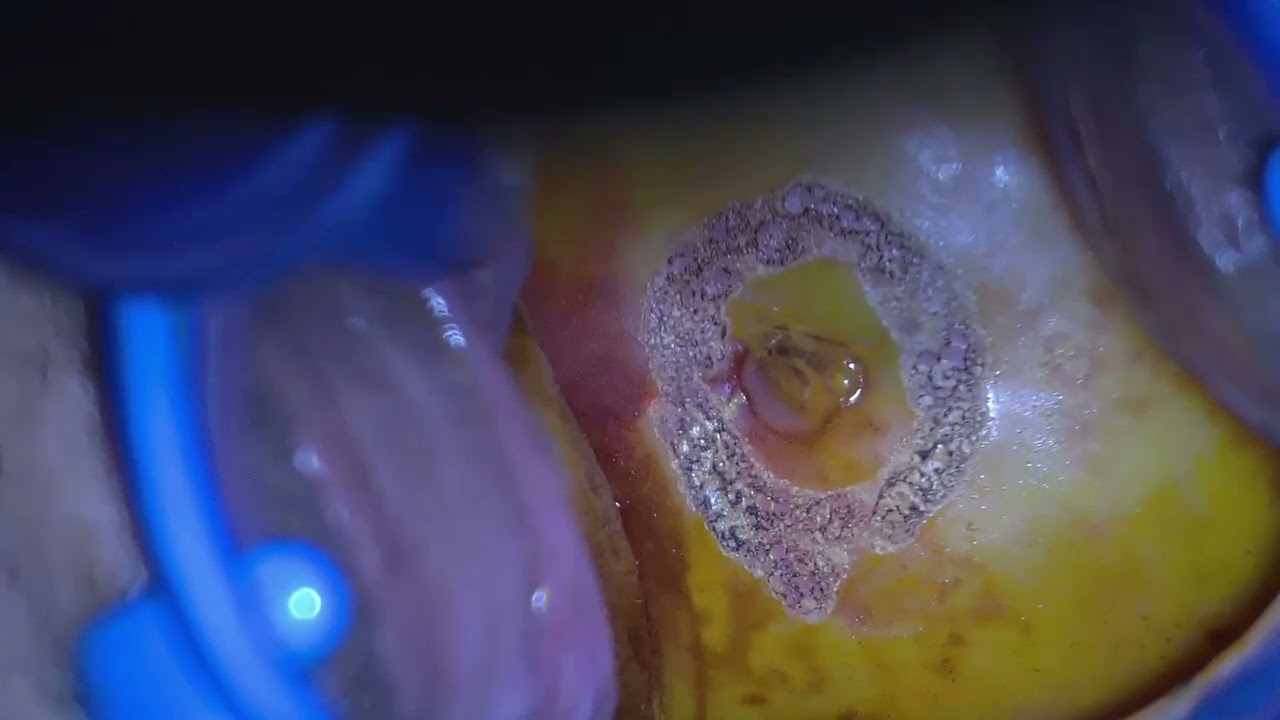 Gonzalo Soto Fuenzalida-12