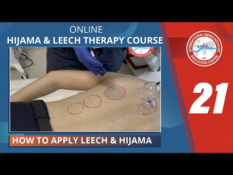 Hijama Institute