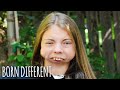I Was Born Without A Jaw | BORN DIFFERENT