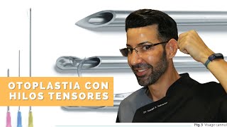 Tratamiento de Otoplastia con Hilos Tensores, sin pasar por el Quirófano