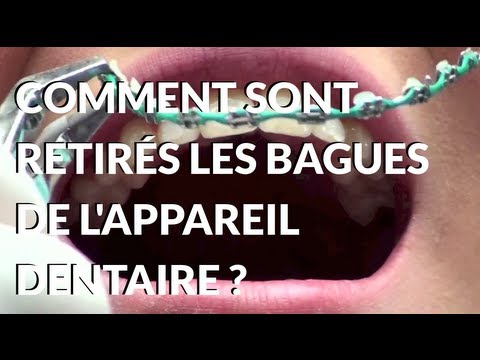 comment nettoyer appareil dentaire