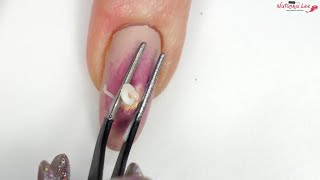 Pimple Popping Nails?