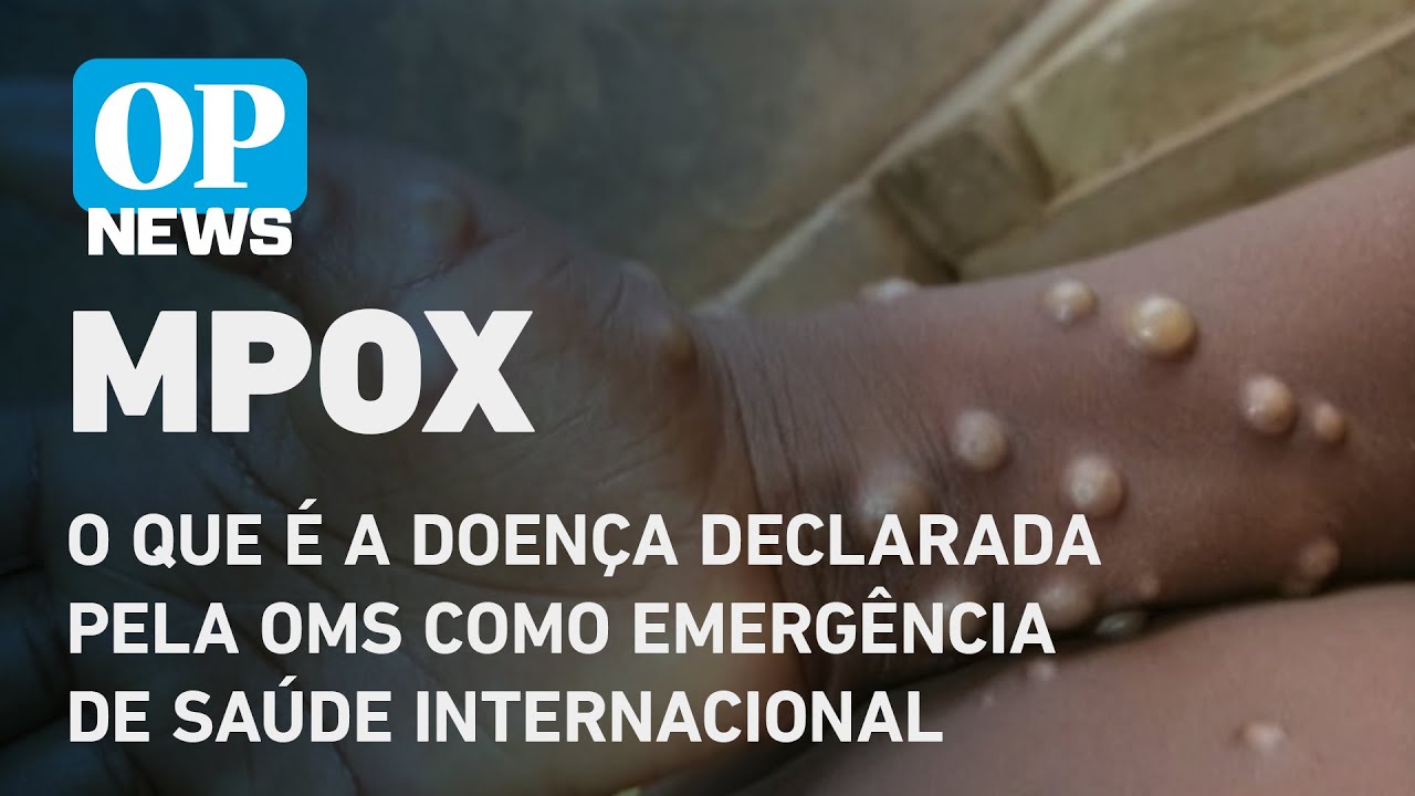 Mpox: o que é a doença, sintomas, como transmite, vacina? l O POVO NEWS