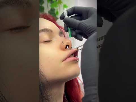 This is a Medusa Lip Piercing 👄