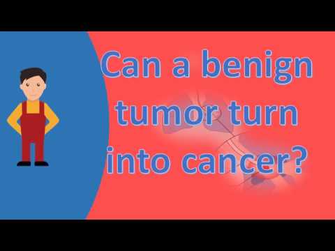 Can a benign tumor turn into cancer ? |Best Health Answers