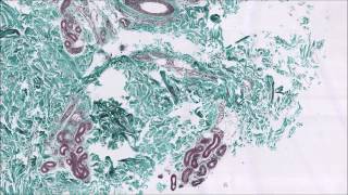 Ghostpoet - X Marks The Spot (Attaque Remix)