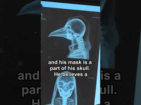 SKULL OPENED! Why does SCP-049 do this?