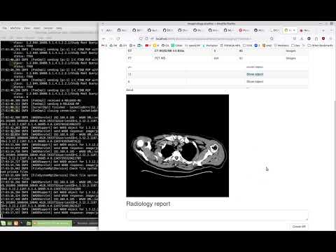 YouTube video