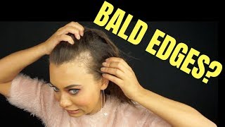 BALD EDGES? WEIRD HAIRLINE? HOW TO HIDE BALD SPOTS OR WEIRD HAIRLINES! | Brittney Gray