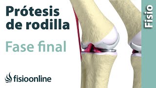 Rehabilitación de Prótesis de Rodilla - Tercera Fase