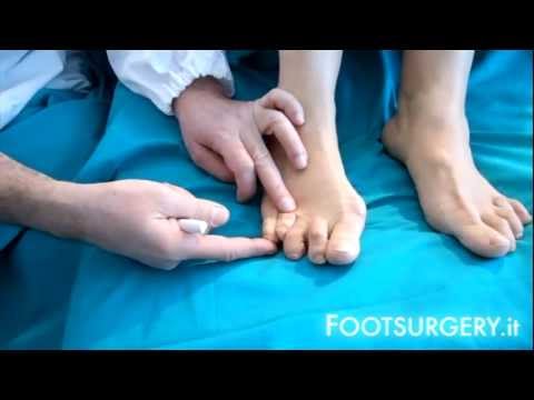 Farmaci per il mal di testa con osteocondrosi cervicale Farmaco koksartroza anca 2 gradi