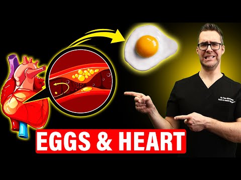 The SHOCKING Truth About Eating Eggs Daily [Heart & Artery Disease]