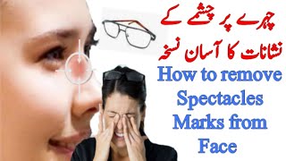 Chashme ke nishan kaise hataye || Spectacle Marks on Nose || Spectacle Marks Removal