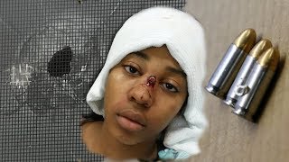 Seattle teen&#39;s life saved by &#39;bulletproof&#39; glasses