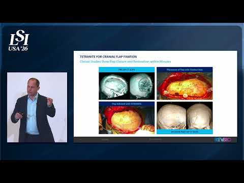Brian Hess, REVBIO - Injectable regenerative bone adhesive for bone repair | LSI USA '26