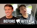 Brennan's *HILARIOUS* Wisdom Tooth Removal Reaction " WHY WOULD THEY DO THAT??"