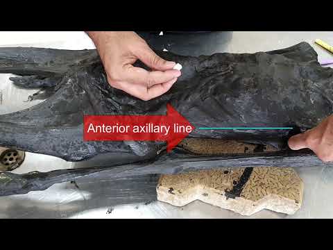 Surface Anatomy of Landmarks of Thorax and Pleura