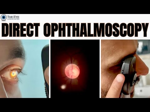Direct Ophthalmoscopy
