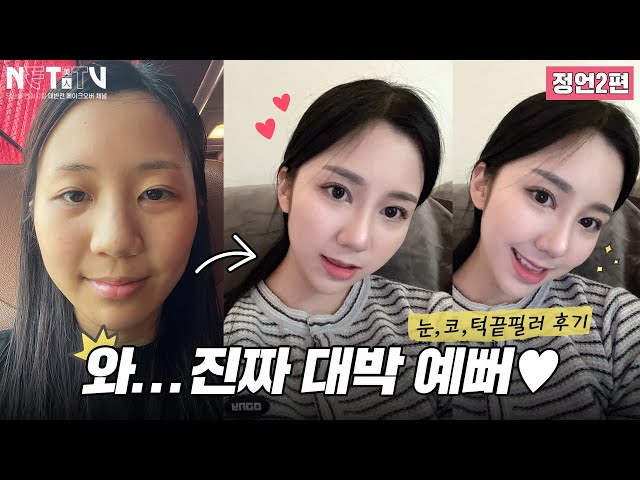 위버스성형외과 I 아름다움, 탁월함, 섬세함 위버스성형외과 I 아름다움, 탁월함, 섬세함